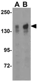 Anti-TBC1D1 antibody used in Western Blot (WB). GTX85437
