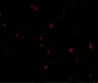 Anti-ORAI3 antibody used in Immunocytochemistry/ Immunofluorescence (ICC/IF). GTX85438
