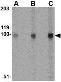 Anti-STIM2 antibody used in Western Blot (WB). GTX85440
