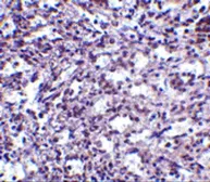 Anti-STIM2 antibody used in IHC (Paraffin sections) (IHC-P). GTX85441