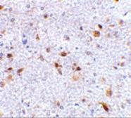 Anti-PD-L2 antibody used in IHC (Paraffin sections) (IHC-P). GTX85449