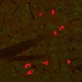 Anti-Choline Acetyltransferase antibody used in IHC (Paraffin sections) (IHC-P). GTX85450