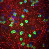 Anti-Coronin 1A antibody used in Immunohistochemistry (IHC). GTX85452