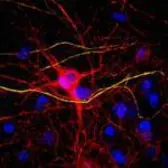 Anti-NF-L antibody used in Immunocytochemistry/ Immunofluorescence (ICC/IF). GTX85460