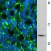 Anti-Myelin PLP antibody used in Immunohistochemistry (IHC). GTX85465