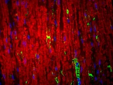 Anti-MPZ antibody used in Immunohistochemistry (IHC). GTX85466
