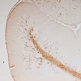 Anti-Vimentin antibody used in Immunohistochemistry (IHC). GTX85471