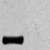 Anti-HA tag antibody used in Western Blot (WB). GTX85473