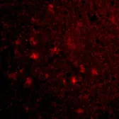 Anti-VISA antibody used in IHC (Paraffin sections) (IHC-P). GTX85481