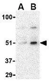 Anti-IRF7 antibody used in Western Blot (WB). GTX85489
