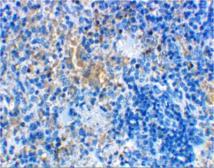 Anti-MD2 antibody used in IHC (Paraffin sections) (IHC-P). GTX85517