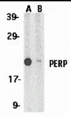 Anti-PERP antibody used in Western Blot (WB). GTX85520