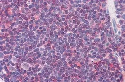 Anti-IL7 Receptor alpha (phospho Tyr449) antibody used in IHC (Paraffin sections) (IHC-P). GTX85604