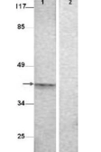 Anti-Aurora B (phospho Thr232) antibody used in Western Blot (WB). GTX85607