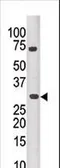 Anti-PIM3 antibody used in Western Blot (WB). GTX85641