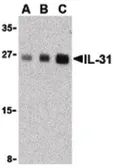 Anti-IL31 antibody used in Western Blot (WB). GTX85642
