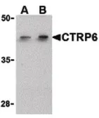 Anti-CTRP6 antibody used in Western Blot (WB). GTX85669