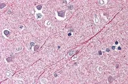 Anti-PHAP3 antibody used in IHC (Paraffin sections) (IHC-P). GTX85687