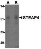 Anti-STEAP4 antibody used in Western Blot (WB). GTX85695