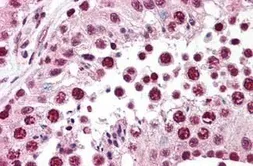 Anti-SPANXC antibody used in IHC (Paraffin sections) (IHC-P). GTX85701