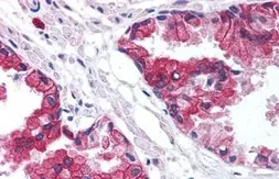 Anti-TMP21 antibody used in IHC (Paraffin sections) (IHC-P). GTX85769