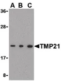 Anti-TMP21 antibody used in Western Blot (WB). GTX85770