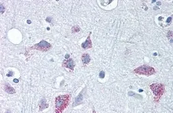 Anti-Wnt8b antibody used in IHC (Paraffin sections) (IHC-P). GTX85814