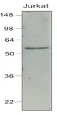 Anti-IRF7 antibody [3D9] used in Western Blot (WB). GTX85864
