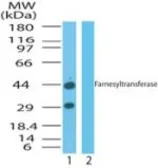 Anti-FNTA antibody used in Western Blot (WB). GTX85881