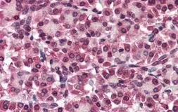 Anti-Glypican 4 antibody used in IHC (Paraffin sections) (IHC-P). GTX85882
