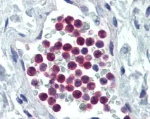 Anti-GM-CSF Receptor alpha antibody used in IHC (Paraffin sections) (IHC-P). GTX85887
