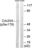 Anti-CDC25A (phospho Ser178) antibody used in Western Blot (WB). GTX86031