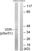 Anti-Vitamin D Receptor (phospho Ser51) antibody used in Western Blot (WB). GTX86040