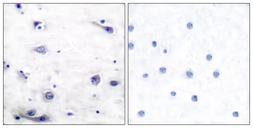 Anti-Tau (phospho Ser422) antibody used in IHC (Paraffin sections) (IHC-P). GTX86147