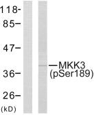 Anti-MEK3 (phospho Ser189) antibody used in Western Blot (WB). GTX86304