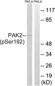Anti-PAK2 (phospho Ser192) antibody used in Western Blot (WB). GTX86345