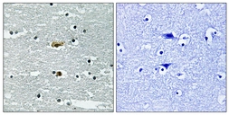 Anti-STK39 (phospho Ser311) antibody used in IHC (Paraffin sections) (IHC-P). GTX86495