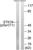 Anti-STK39 (phospho Ser311) antibody used in Western Blot (WB). GTX86495