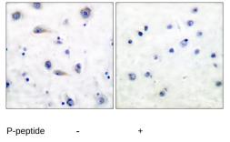 Anti-TrkB (phospho Tyr515) antibody used in IHC (Paraffin sections) (IHC-P). GTX86536