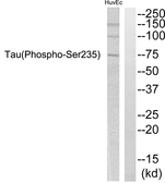Anti-Tau (phospho Ser235) antibody used in Western Blot (WB). GTX86624