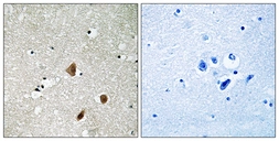 Anti-PAK3 (phospho Ser154) antibody used in IHC (Paraffin sections) (IHC-P). GTX86634