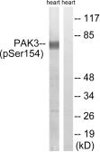 Anti-PAK3 (phospho Ser154) antibody used in Western Blot (WB). GTX86634