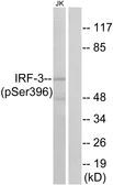 Anti-IRF3 (phospho Ser396) antibody used in Western Blot (WB). GTX86691