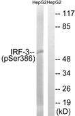 Anti-IRF3 (phospho Ser386) antibody used in Western Blot (WB). GTX86736