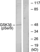 Anti-GSK3 beta (phospho Ser9) antibody used in Western Blot (WB). GTX86837