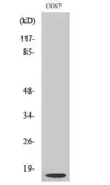 Anti-Cathepsin D (cleaved Gly65) antibody used in Western Blot (WB). GTX86884