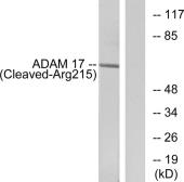 Anti-ADAM17 (cleaved Arg215) antibody used in Western Blot (WB). GTX86885