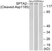 Anti-alpha Fodrin (cleaved Asp1185) antibody used in Western Blot (WB). GTX86886
