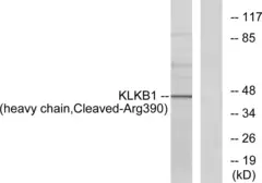 Anti-Plasma Kallikrein 1B (cleaved Arg390) antibody used in Western Blot (WB). GTX86891