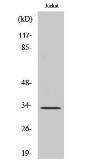 Anti-Cathepsin A (cleaved Arg326) antibody used in Western Blot (WB). GTX86895